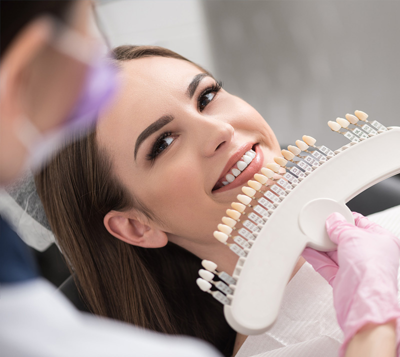 porcelain veneers in chilliwack