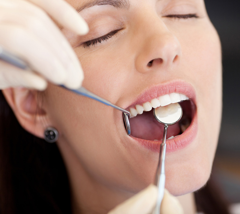 sedation dentistry in chilliwack