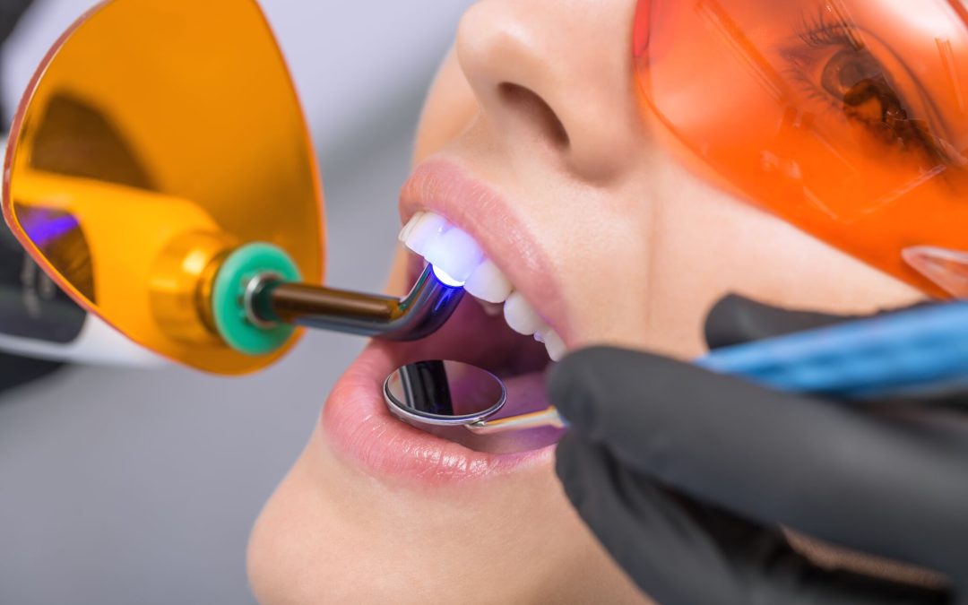 your guide to laser dentistry