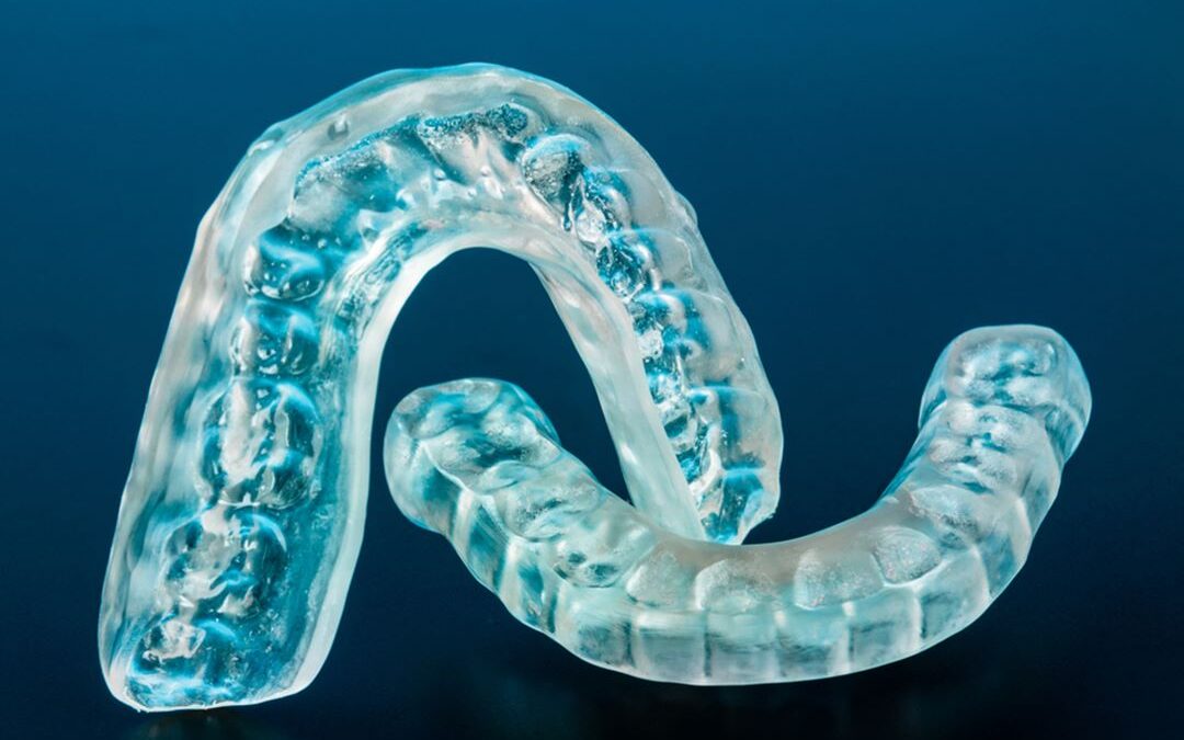Dental Guards and Appliances in Chilliwack